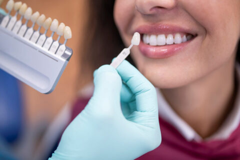 Preparing teeth for Veener