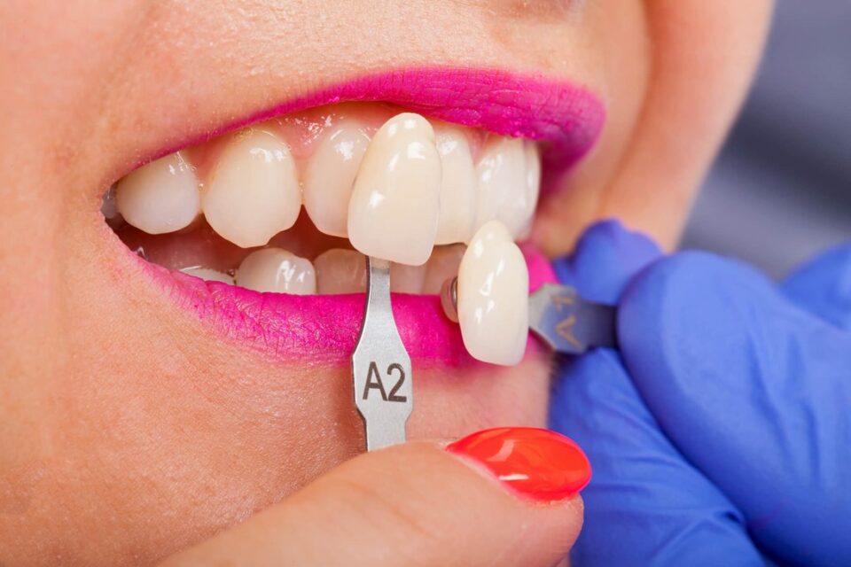 A close-up of a person's teeth