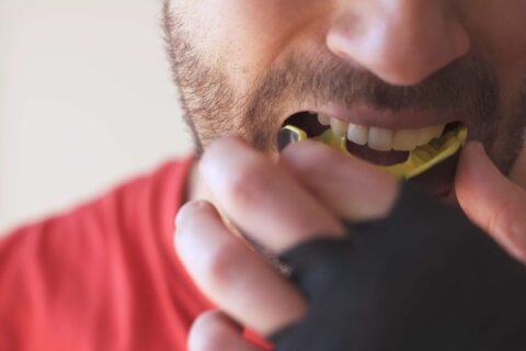 A close-up of a person putting in a mouthguard